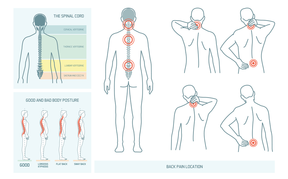 Back pain locations, spinal chord diagram and postures